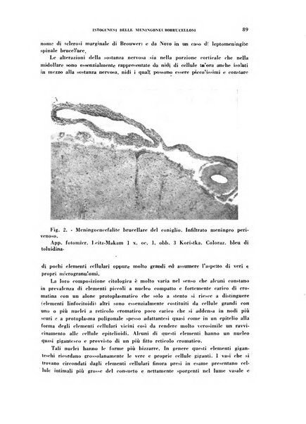 Nevrasse fisiopatologia e clinica del sistema nervoso centrale, neurochirurgia, neuroradiologia, psichiatria