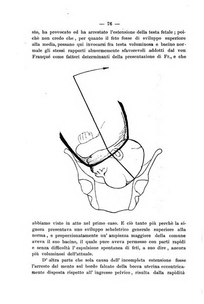 La rassegna d'ostetricia e ginecologia