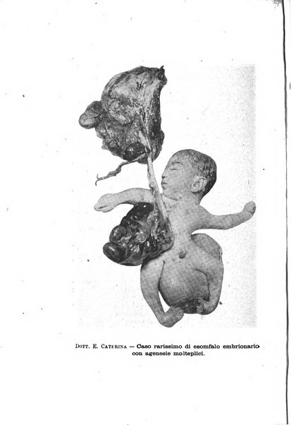 La rassegna d'ostetricia e ginecologia