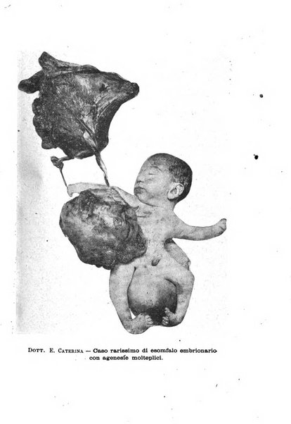 La rassegna d'ostetricia e ginecologia