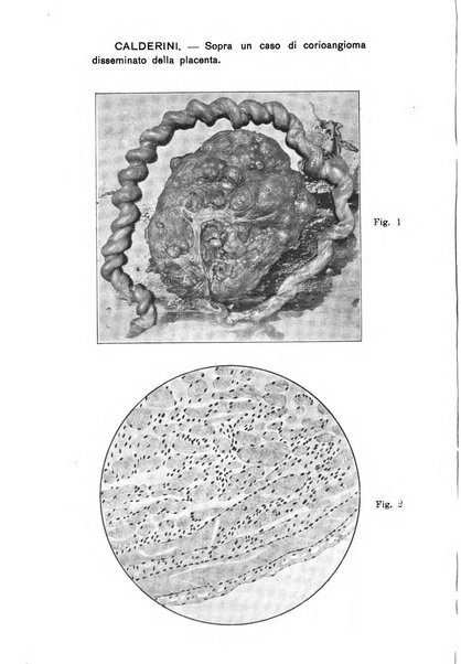 La rassegna d'ostetricia e ginecologia