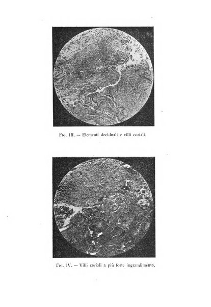 La rassegna d'ostetricia e ginecologia