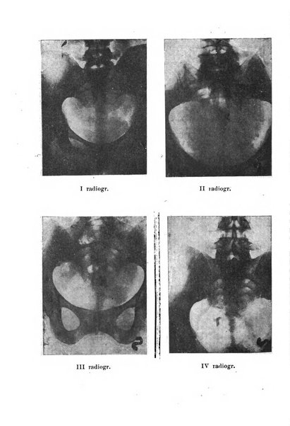 La rassegna d'ostetricia e ginecologia