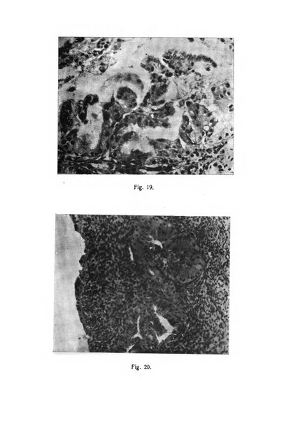 La rassegna d'ostetricia e ginecologia