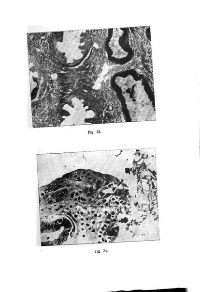 La rassegna d'ostetricia e ginecologia