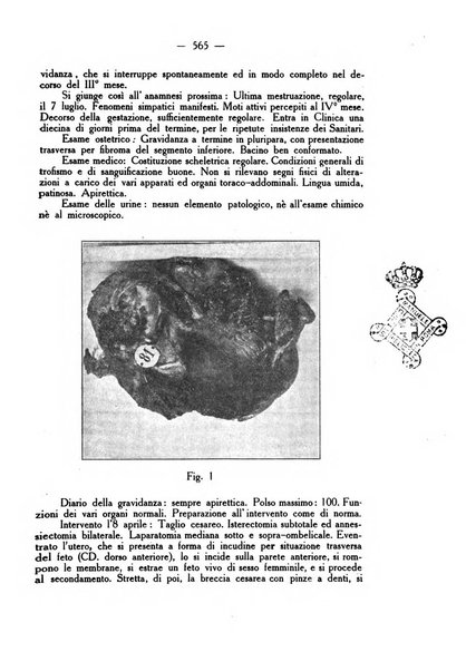 La rassegna d'ostetricia e ginecologia