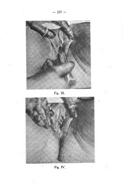 La rassegna d'ostetricia e ginecologia