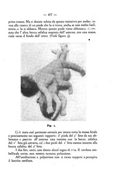 La rassegna d'ostetricia e ginecologia