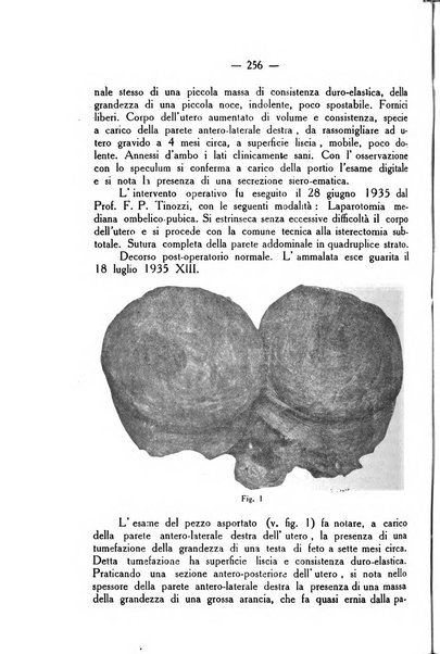 La rassegna d'ostetricia e ginecologia