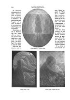 giornale/LO10015867/1920/unico/00000250