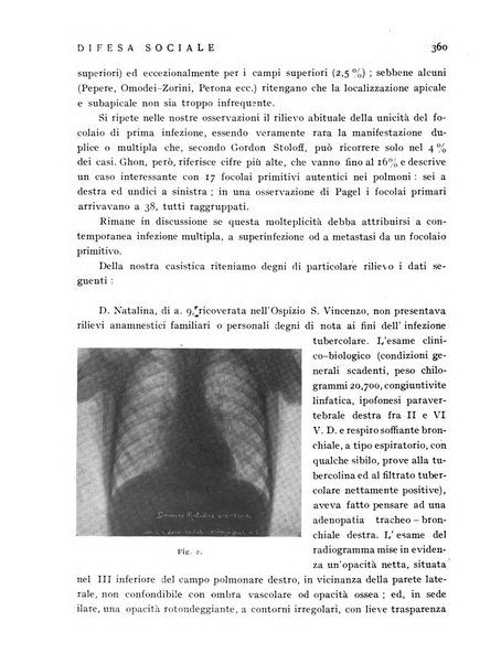 Difesa sociale rivista di igiene, previdenza ed assistenza