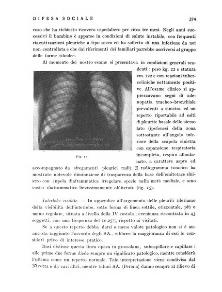 Difesa sociale rivista di igiene, previdenza ed assistenza