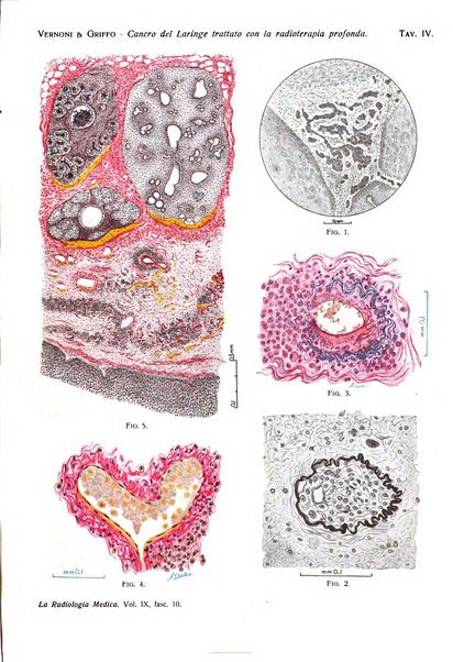 La radiologia medica rivista mensile