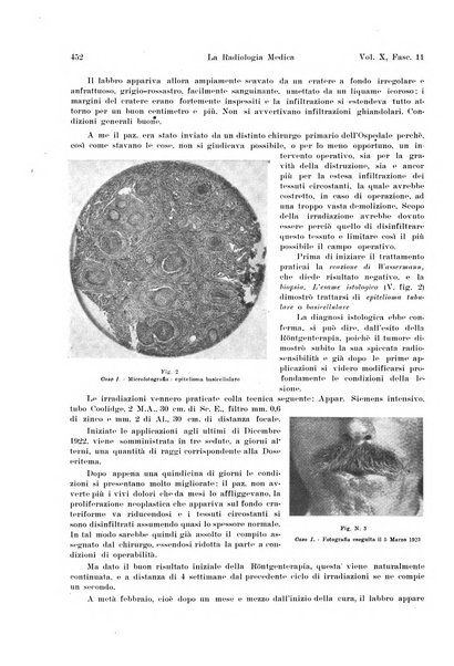 La radiologia medica rivista mensile