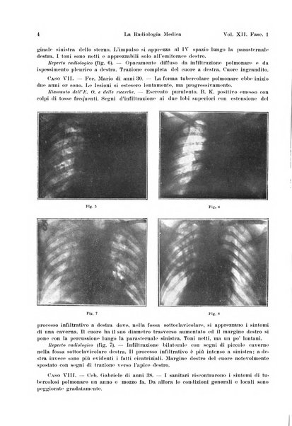 La radiologia medica rivista mensile