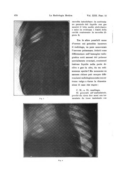 La radiologia medica rivista mensile