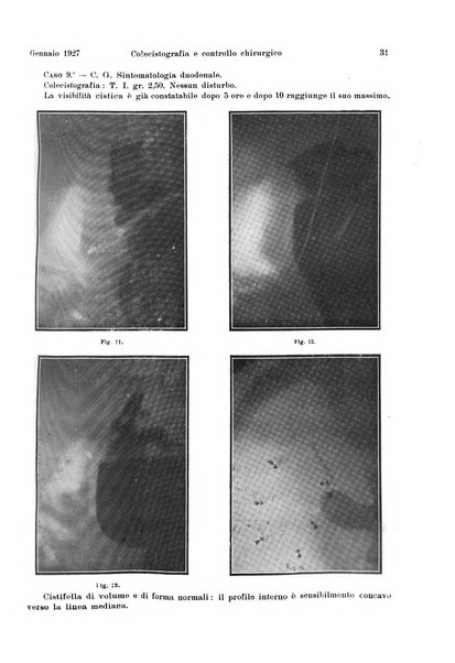 La radiologia medica rivista mensile