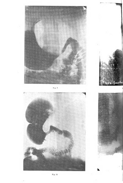 La radiologia medica rivista mensile