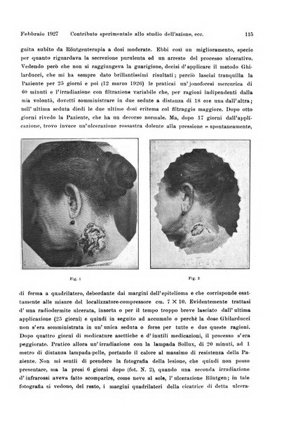 La radiologia medica rivista mensile