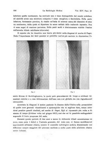 La radiologia medica rivista mensile