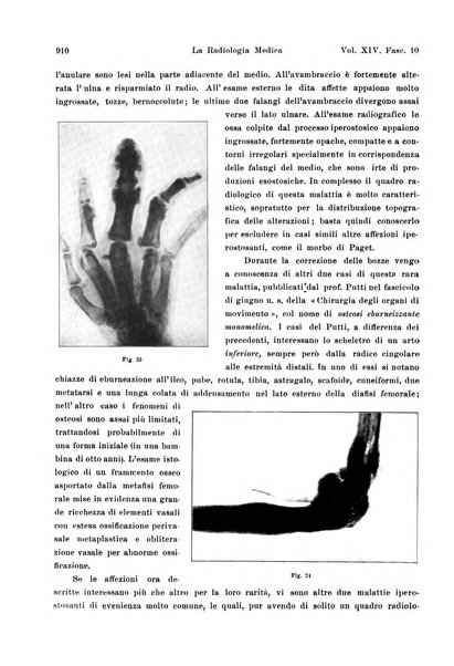 La radiologia medica rivista mensile