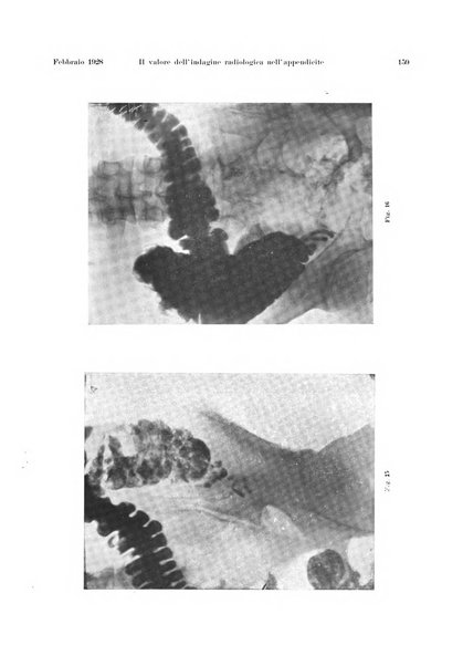 La radiologia medica rivista mensile