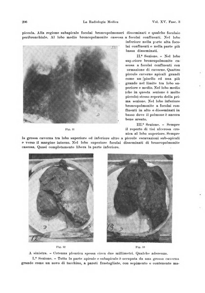 La radiologia medica rivista mensile