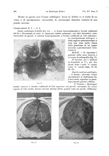 La radiologia medica rivista mensile