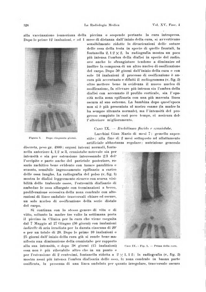 La radiologia medica rivista mensile