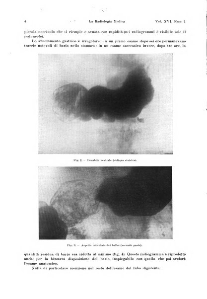 La radiologia medica rivista mensile