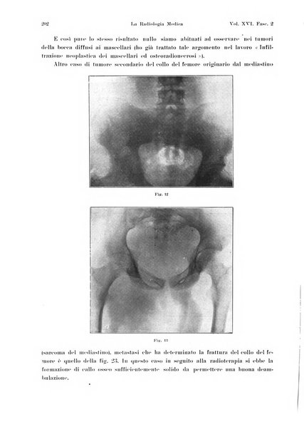 La radiologia medica rivista mensile