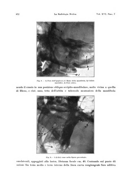 La radiologia medica rivista mensile