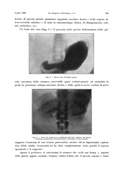 La radiologia medica rivista mensile