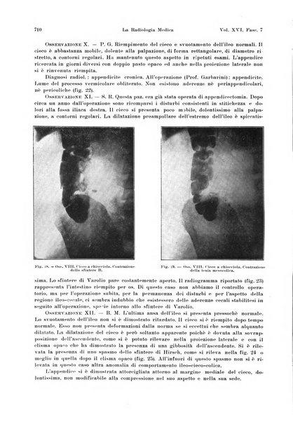 La radiologia medica rivista mensile