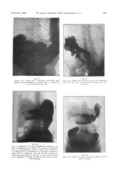 La radiologia medica rivista mensile