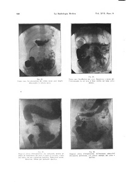 La radiologia medica rivista mensile