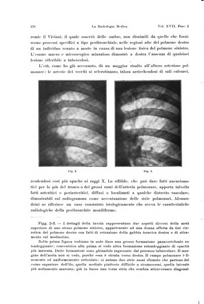 La radiologia medica rivista mensile