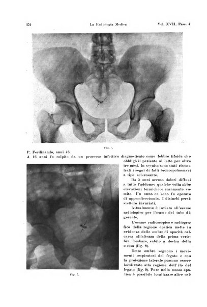 La radiologia medica rivista mensile