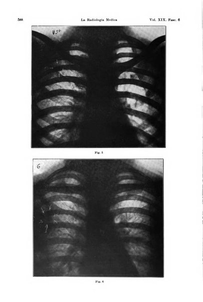 La radiologia medica rivista mensile