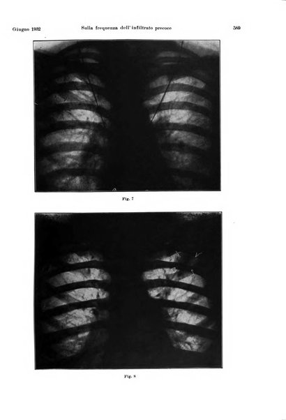 La radiologia medica rivista mensile