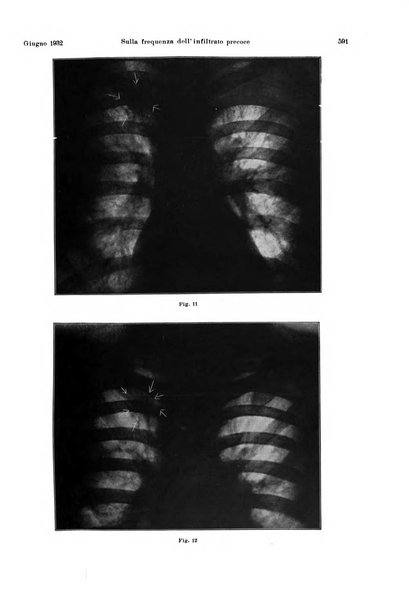 La radiologia medica rivista mensile