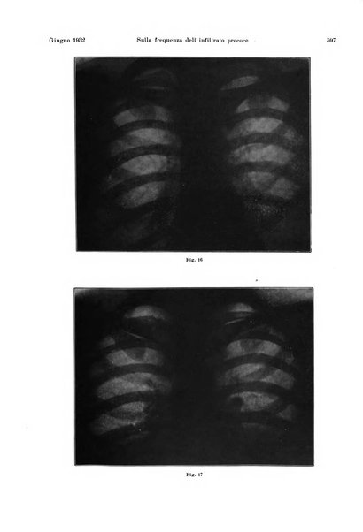 La radiologia medica rivista mensile