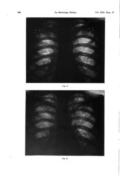 La radiologia medica rivista mensile