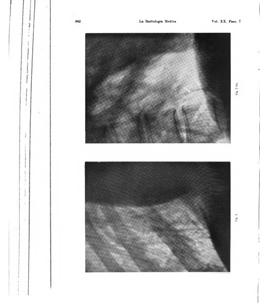 La radiologia medica rivista mensile