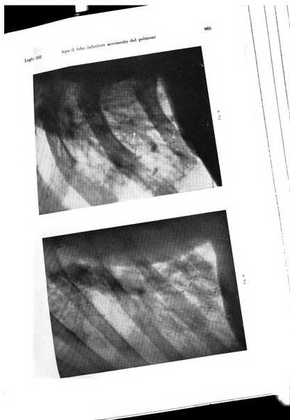 La radiologia medica rivista mensile