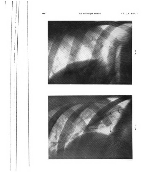 La radiologia medica rivista mensile