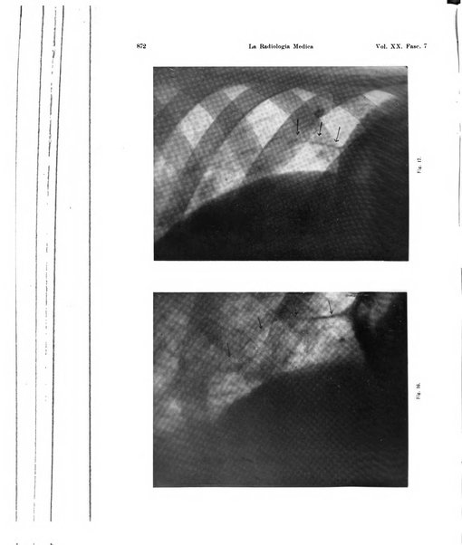 La radiologia medica rivista mensile