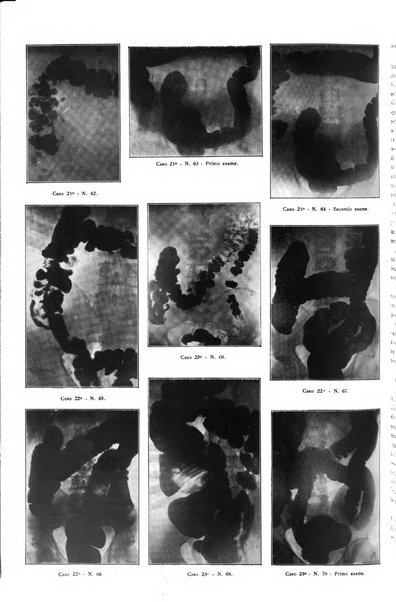 La radiologia medica rivista mensile