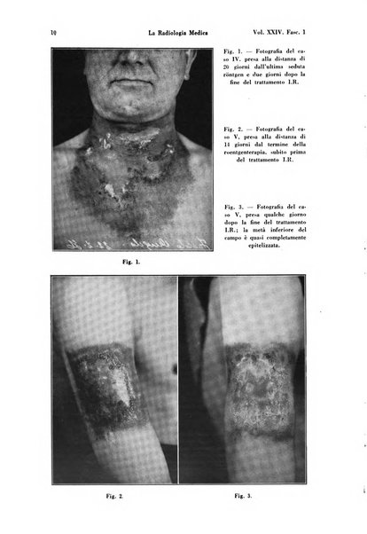 La radiologia medica rivista mensile