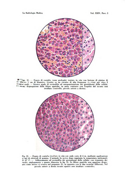 La radiologia medica rivista mensile